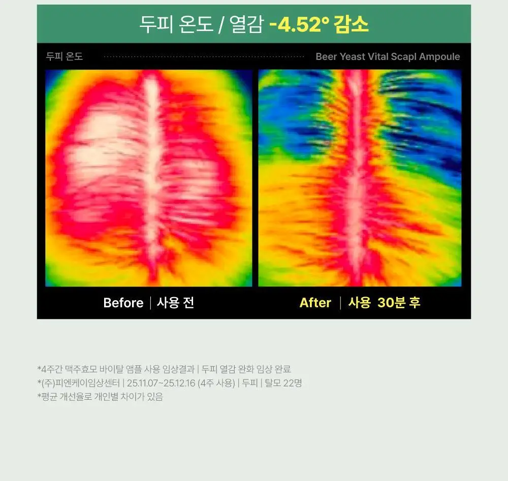 [5종임상완료/4주탈모케어] 애쉬로렌 맥주효모 바이탈 스칼프 앰플 100ml 상세페이지 43